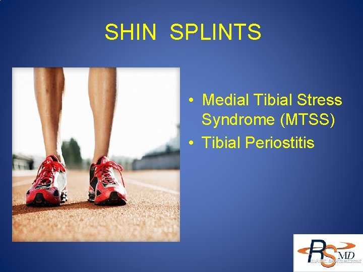SHIN SPLINTS • Medial Tibial Stress Syndrome (MTSS) • Tibial Periostitis 