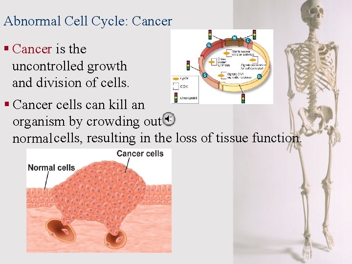Abnormal Cell Cycle: Cancer § Cancer is the uncontrolled growth and division of cells.