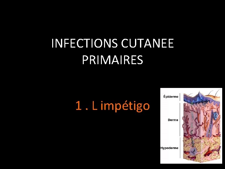 INFECTIONS CUTANEE PRIMAIRES 1. L impétigo 