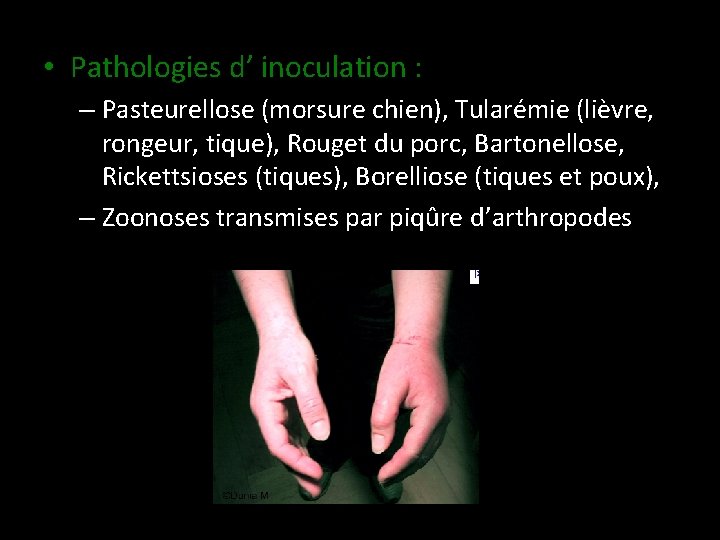  • Pathologies d’ inoculation : – Pasteurellose (morsure chien), Tularémie (lièvre, rongeur, tique),