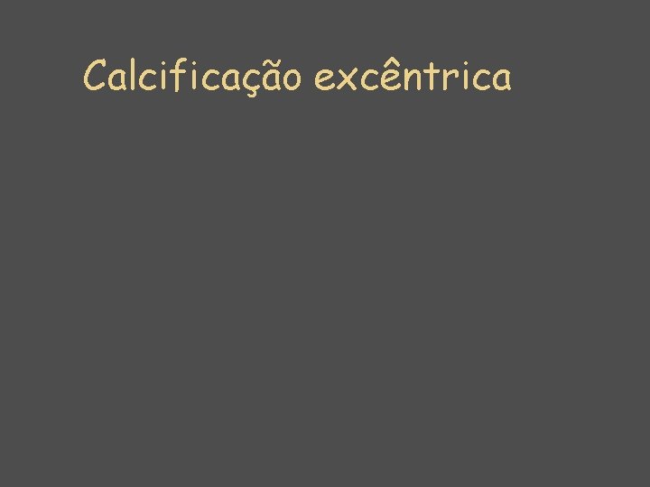 Calcificação excêntrica 