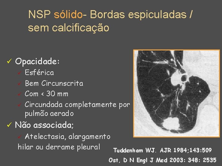 NSP sólido- Bordas espiculadas / sem calcificação ü Opacidade: ü ü ü Esférica Bem