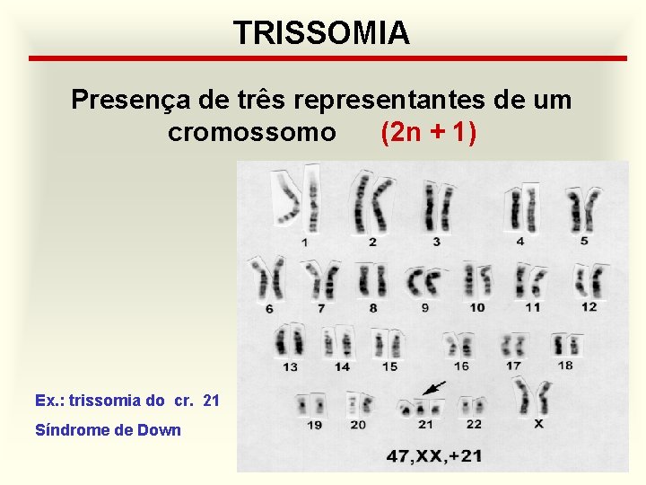 TRISSOMIA Presença de três representantes de um cromossomo (2 n + 1) Ex. :
