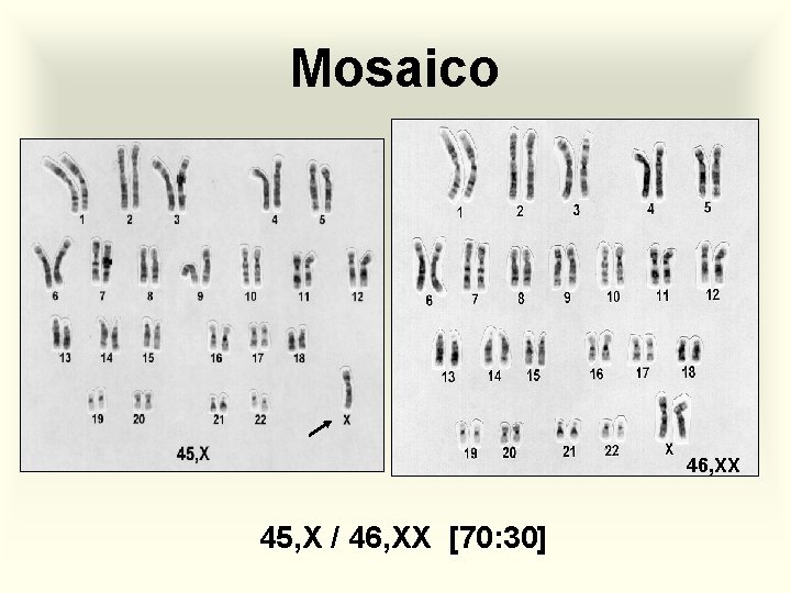 Mosaico 46, XX 45, X / 46, XX [70: 30] 