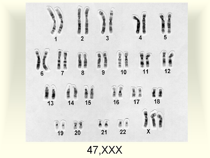 47, XXX 