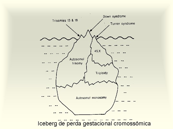 Iceberg de perda gestacional cromossômica 