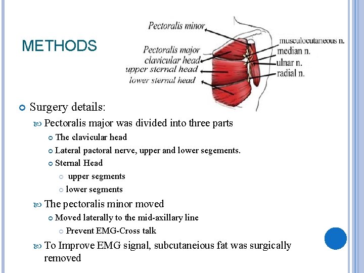 METHODS Surgery details: Pectoralis major was divided into three parts The clavicular head Lateral