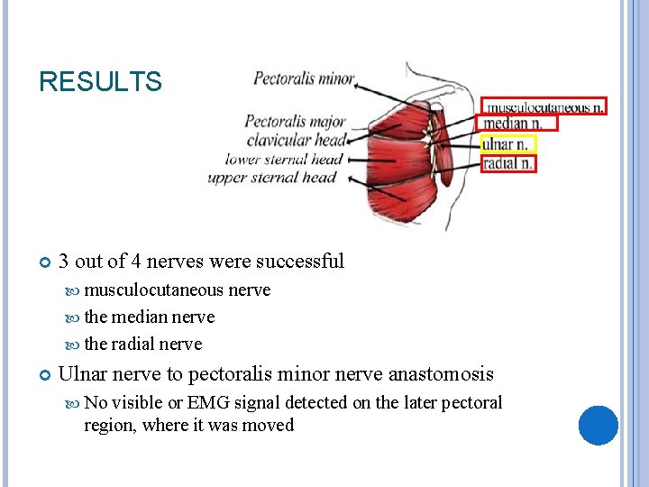 RESULTS 3 out of 4 nerves were successful musculocutaneous nerve the median nerve the