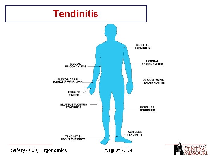 Tendinitis Safety 4000, Ergonomics August 2008 