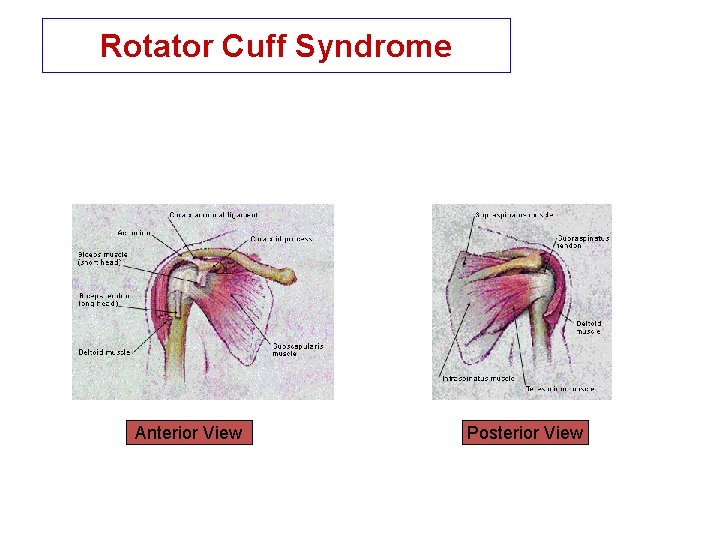 Rotator Cuff Syndrome Anterior View Posterior View 