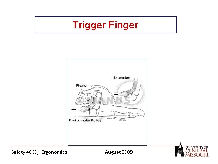 Trigger Finger Safety 4000, Ergonomics August 2008 