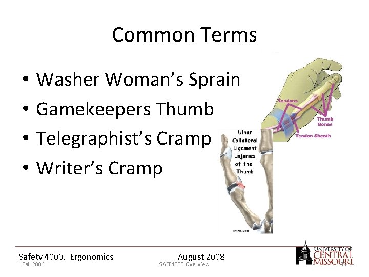 Common Terms • • Washer Woman’s Sprain Gamekeepers Thumb Telegraphist’s Cramp Writer’s Cramp Safety