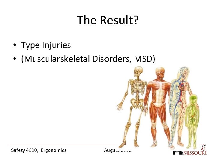 The Result? • Type Injuries • (Muscularskeletal Disorders, MSD) Safety 4000, Ergonomics August 2008