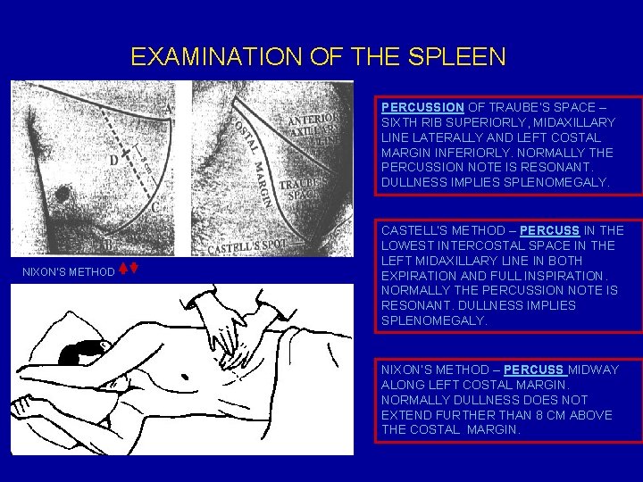 EXAMINATION OF THE SPLEEN PERCUSSION OF TRAUBE’S SPACE – SIXTH RIB SUPERIORLY, MIDAXILLARY LINE