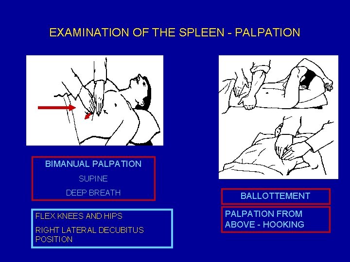 EXAMINATION OF THE SPLEEN - PALPATION BIMANUAL PALPATION SUPINE DEEP BREATH FLEX KNEES AND