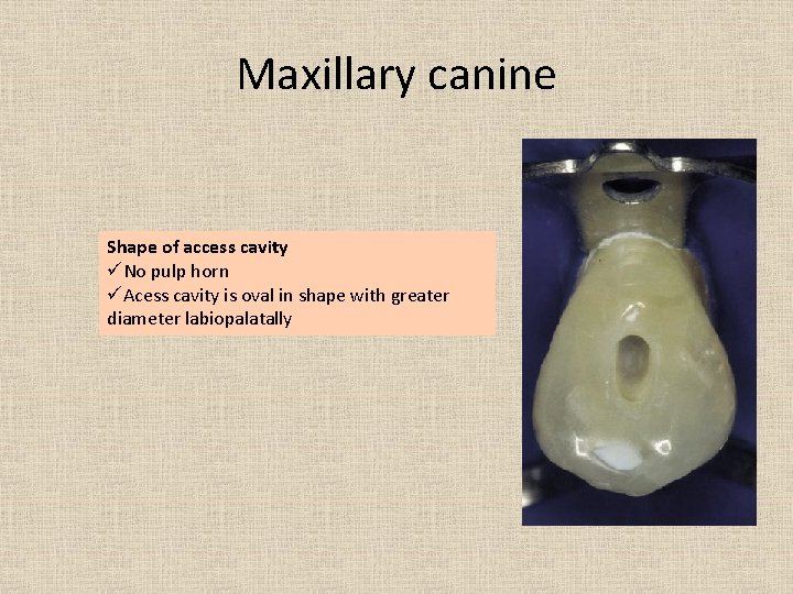 Maxillary canine Shape of access cavity üNo pulp horn üAcess cavity is oval in