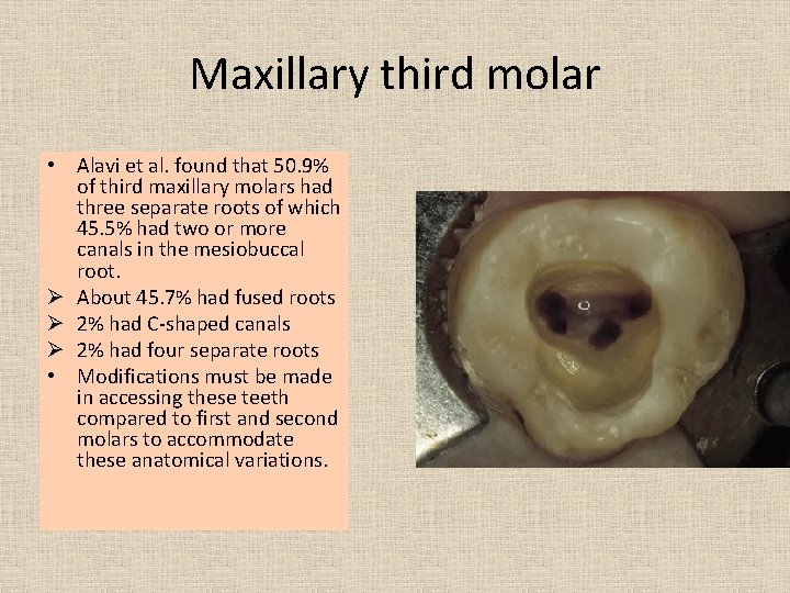 Maxillary third molar • Alavi et al. found that 50. 9% of third maxillary