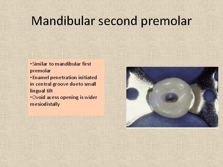 Mandibular second premolar • Similar to mandibular first premolar • Enamel penetration initiated in