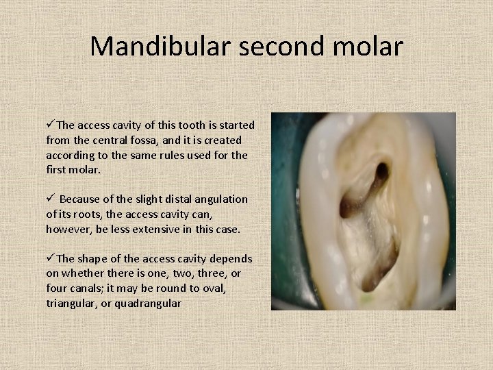 Mandibular second molar üThe access cavity of this tooth is started from the central