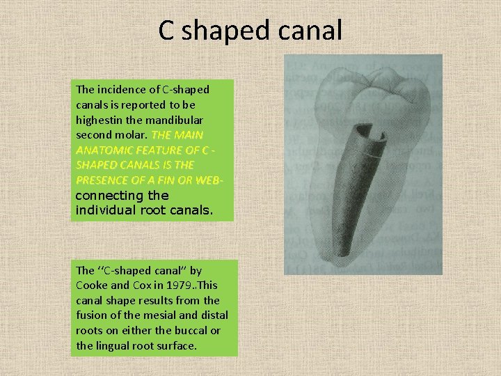 C shaped canal The incidence of C-shaped canals is reported to be highestin the