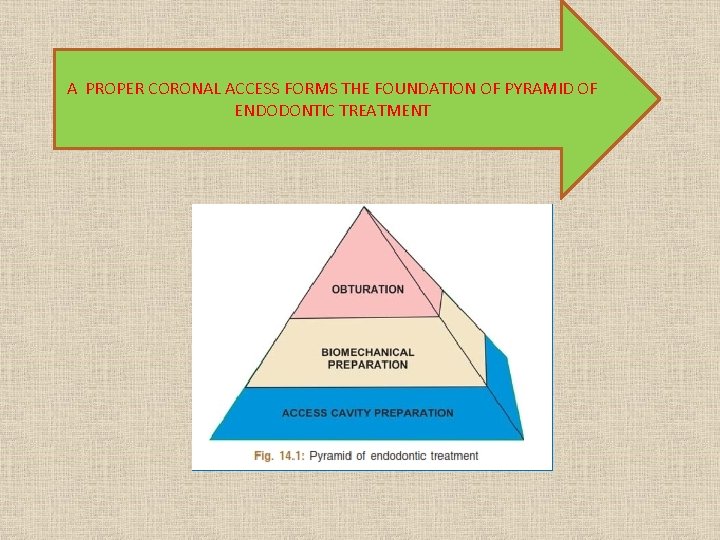 A PROPER CORONAL ACCESS FORMS THE FOUNDATION OF PYRAMID OF ENDODONTIC TREATMENT 