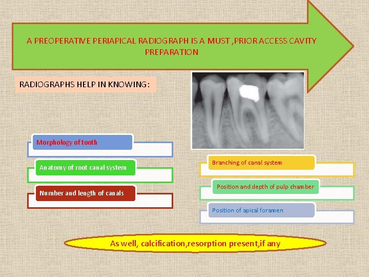 A PREOPERATIVE PERIAPICAL RADIOGRAPH IS A MUST , PRIOR ACCESS CAVITY PREPARATION RADIOGRAPHS HELP