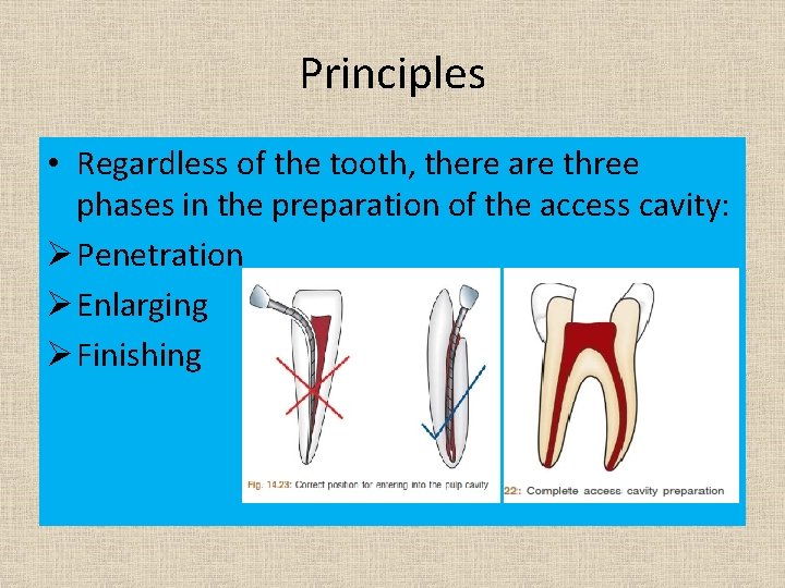 Principles • Regardless of the tooth, there are three phases in the preparation of