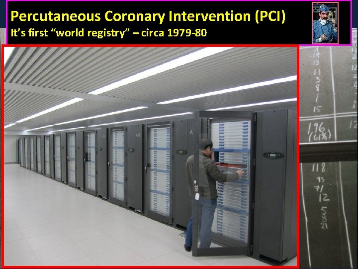 Percutaneous Coronary Intervention (PCI) It’s first “world registry” – circa 1979 -80 
