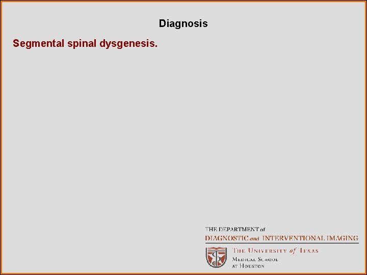 Diagnosis Segmental spinal dysgenesis. 