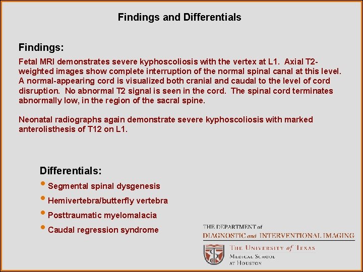 Findings and Differentials Findings: Fetal MRI demonstrates severe kyphoscoliosis with the vertex at L