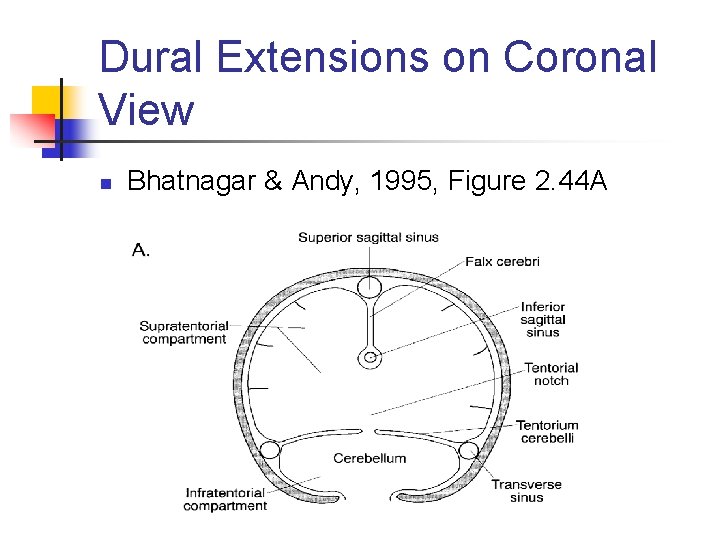 Dural Extensions on Coronal View n Bhatnagar & Andy, 1995, Figure 2. 44 A