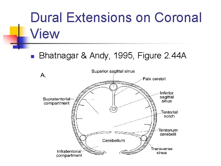 Dural Extensions on Coronal View n Bhatnagar & Andy, 1995, Figure 2. 44 A