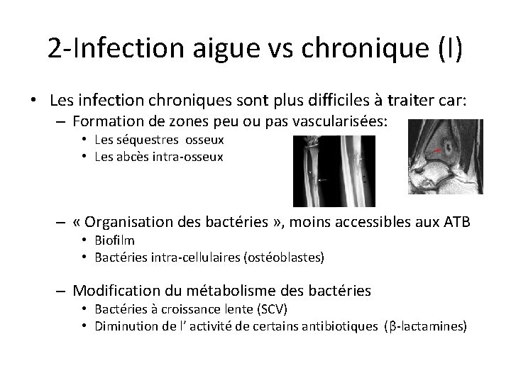 2 -Infection aigue vs chronique (I) • Les infection chroniques sont plus difficiles à