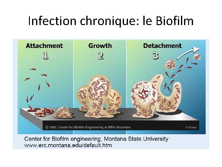 Infection chronique: le Biofilm 