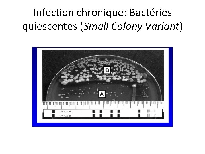 Infection chronique: Bactéries quiescentes (Small Colony Variant) 