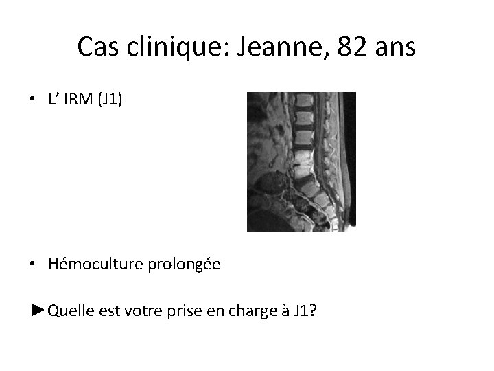 Cas clinique: Jeanne, 82 ans • L’ IRM (J 1) • Hémoculture prolongée ►Quelle