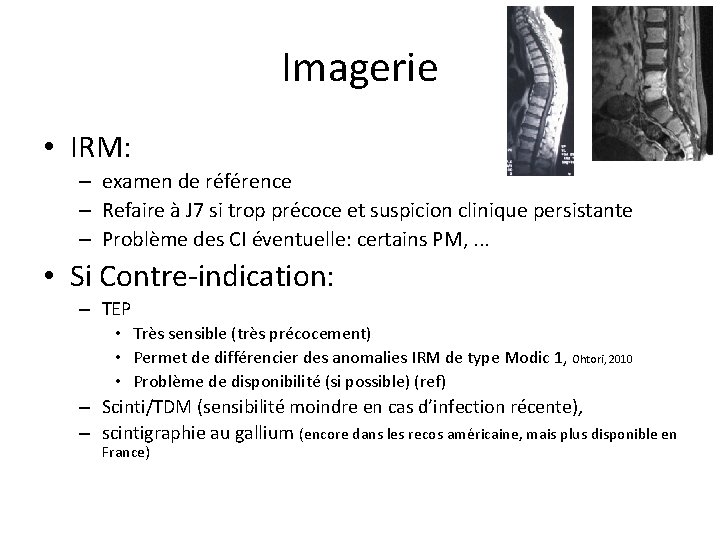 Imagerie • IRM: – examen de référence – Refaire à J 7 si trop