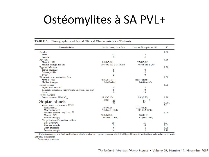 Ostéomylites à SA PVL+ 