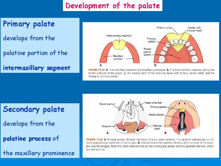 Development of the palate Primary palate develops from the palatine portion of the intermaxillary