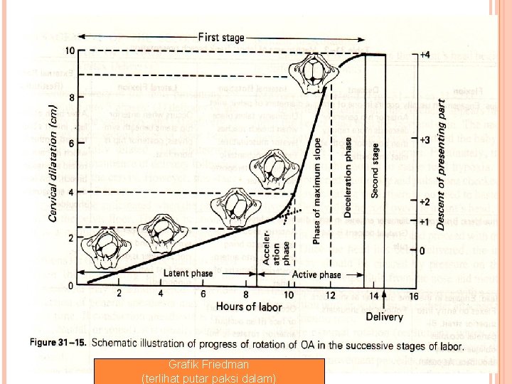 Grafik Friedman (terlihat putar paksi dalam) 