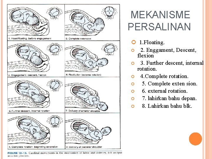 MEKANISME PERSALINAN 1. Floating. 2. Enggament, Descent, flexion 3. Further descent, internal rotation. 4.