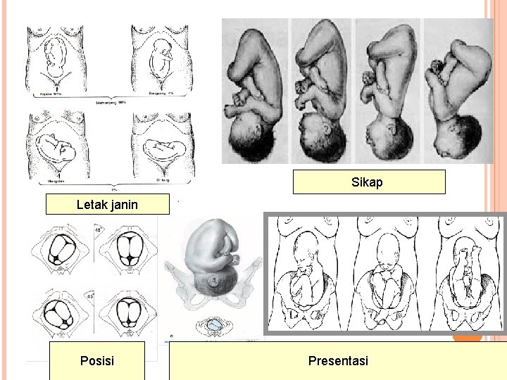 Sikap Letak janin Posisi Presentasi 