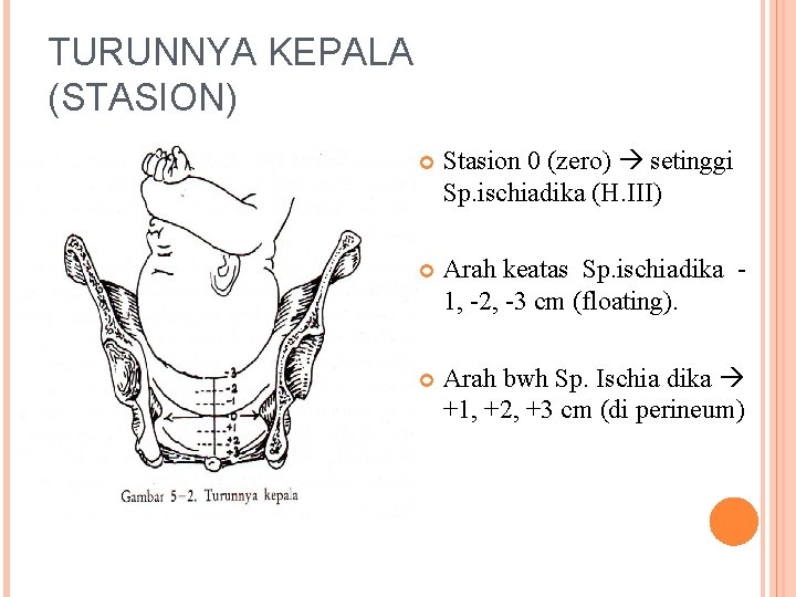 TURUNNYA KEPALA (STASION) Stasion 0 (zero) setinggi Sp. ischiadika (H. III) Arah keatas Sp.