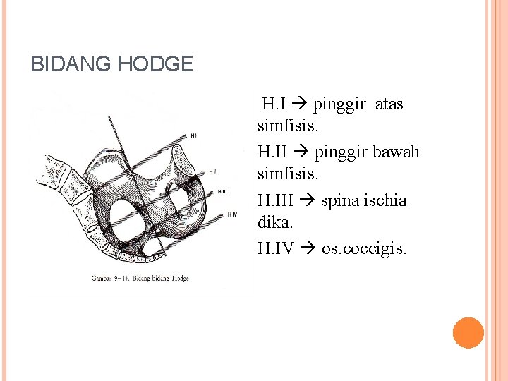 BIDANG HODGE H. I pinggir atas simfisis. H. II pinggir bawah simfisis. H. III