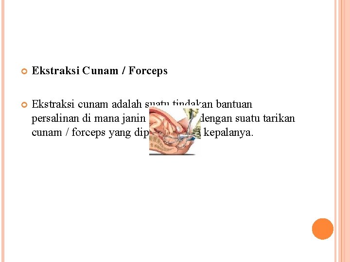  Ekstraksi Cunam / Forceps Ekstraksi cunam adalah suatu tindakan bantuan persalinan di mana