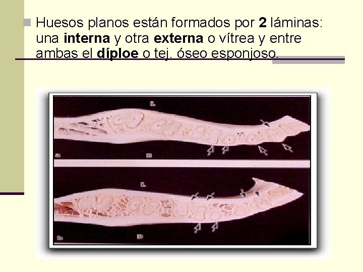 n Huesos planos están formados por 2 láminas: una interna y otra externa o