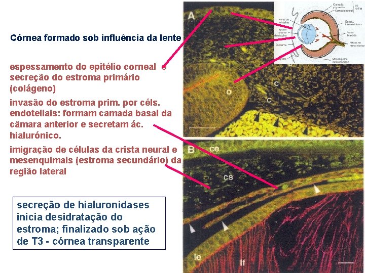 Córnea formado sob influência da lente espessamento do epitélio corneal e secreção do estroma