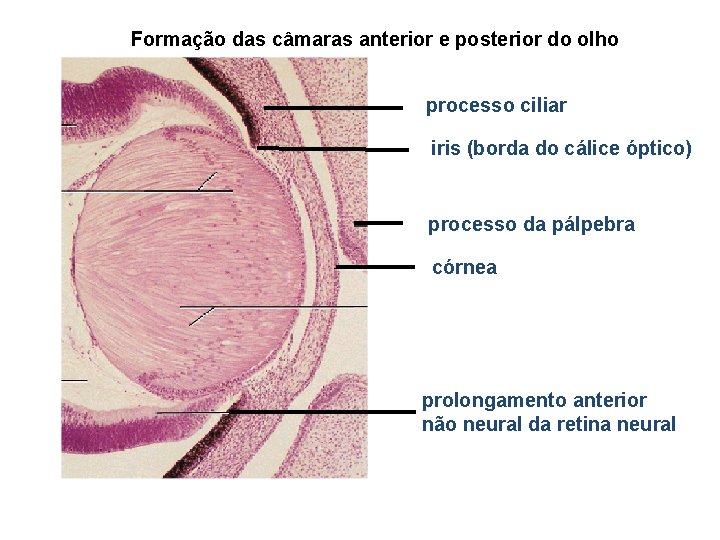 Formação das câmaras anterior e posterior do olho processo ciliar iris (borda do cálice