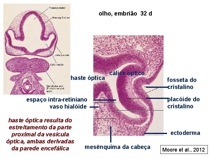 olho, embrião 32 d haste óptica cálice óptico espaço intra-retiniano vaso hialóide haste óptica