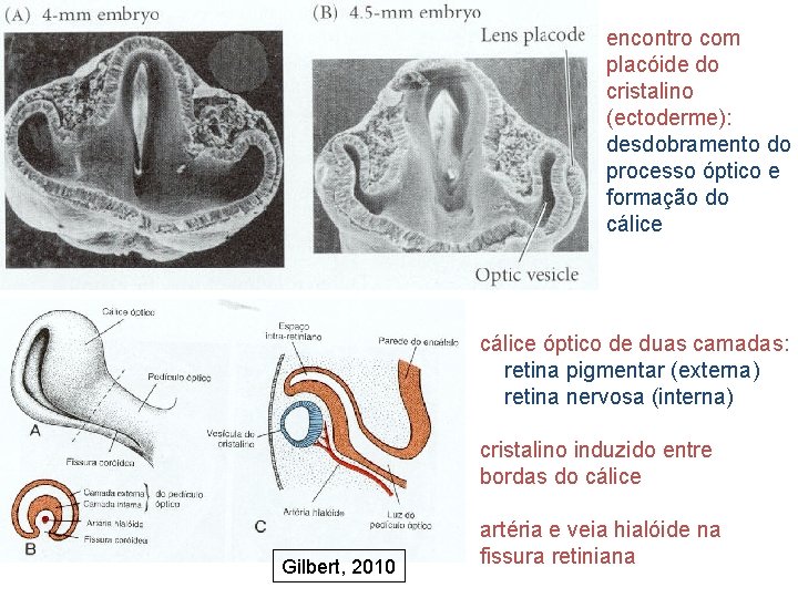 encontro com placóide do cristalino (ectoderme): desdobramento do processo óptico e formação do cálice